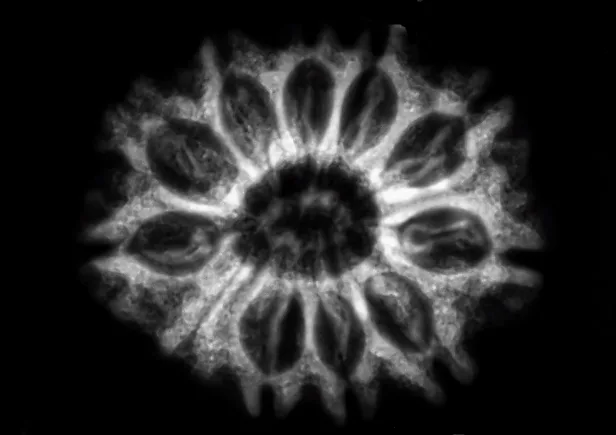 X-ray image of a rudraksha bead showing its seed compartments arranged around a central axis